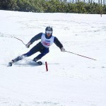 内倒気味の原因はシェーレンです