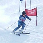 トップの浮きが気になりますね トップの浮きが気になりますね