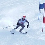 内膝が外に開いてのシェーレン型は直しましょう 内膝が外に開いてのシェーレン型は直しましょう