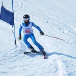 後傾がシェーレン型をうんでいます。直しましょう 後傾がシェーレン型をうんでいます。直しましょう