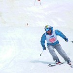 その為、身体が浮いてのシェーレン型は直しましょう