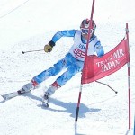 シェーレン型を直すのは難しいですね シェーレン型を直すのは難しいですね