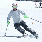 内傾角も倒れています◎シェーレン型をなおしましょう