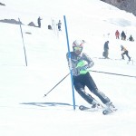 腕も前方！シェーレン型も直し！アンギュレーションも！◎