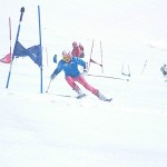 失敗例　シェーレン型