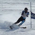 左骨盤をもう少しあげることでシェーレン型がなくなります