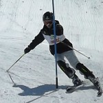 シェーレン型を直せばグッドになります