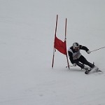 上体がつぶれ、骨盤が下がってのシェーレン型です