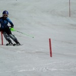 アンギュレーションも正確に◎