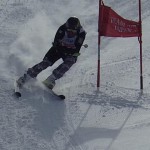 前後差がシェーレン型を・・・