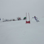 アンギュレーション◎